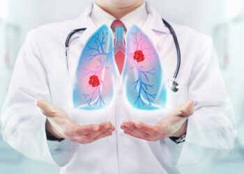 TÜDŐRÁK – A leggyakoribb daganatos betegség