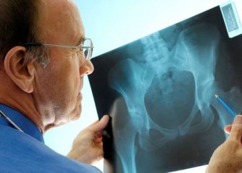 VÁRÓLISTA – Míg bele nem döglesz