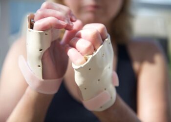 SCLERODERMA – Egy ritka betegség, amely testünk kötőszöveteit érinti