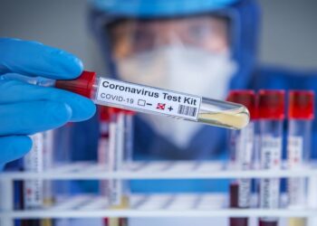 KORONAVÍRUS – Május 1-jén indul a tömegtesztelés Magyarországon