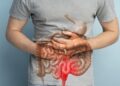 Enyh&iacute;theti a Crohn-betegs&eacute;g t&uuml;neteit a CBD?