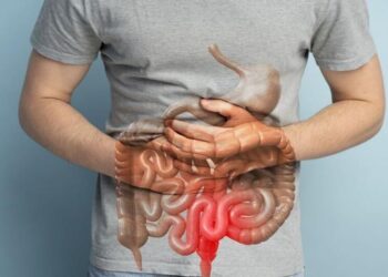 Enyh&iacute;theti a Crohn-betegs&eacute;g t&uuml;neteit a CBD?