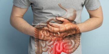 Enyh&iacute;theti a Crohn-betegs&eacute;g t&uuml;neteit a CBD?